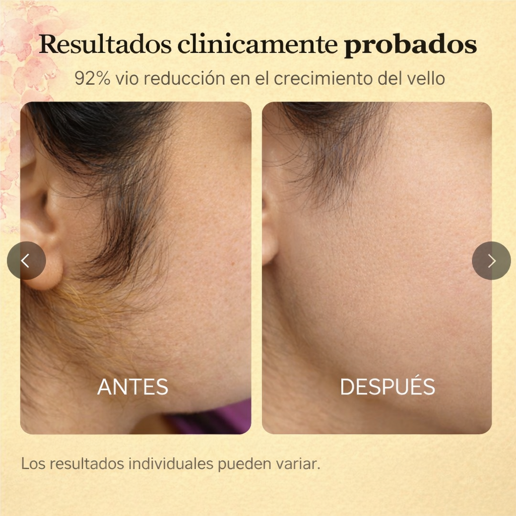 Aceite Cyperus Rotundus™: Frena el Vello, Hidrata tu Piel Naturalmente.