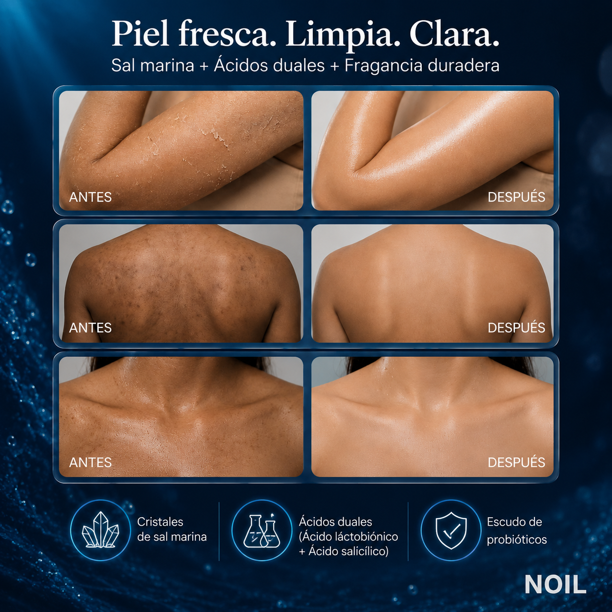 Noil-Gel Corporal™: Aroma de 72 Horas + Piel sin Granitos