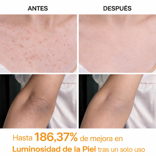 Dr.Melaxin Spray Exfoliante: Aclara Manchas y Renueva la Piel